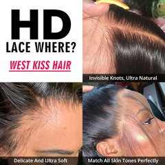 Loose Deep Wave Wigs 5*5 Closure Wigs Brazilian Lace Closure Wigs For Sale
